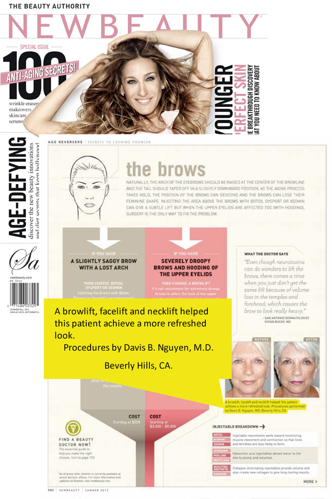 New Beauty Magazine article featuring Davis B. Nguyen, M.D.
