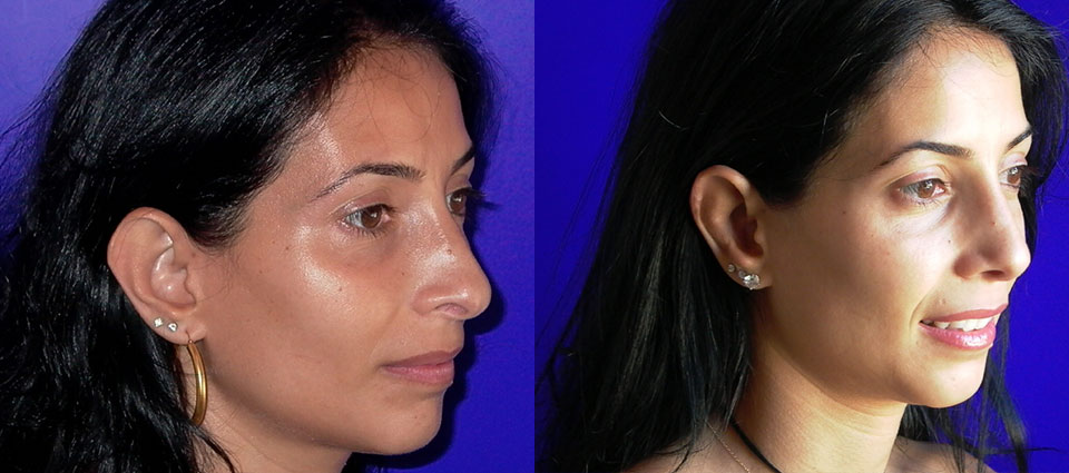 Before and After - Dr. Nguyen